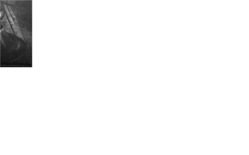 Kerzenanimation